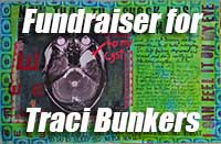 fundraiser for Traci Bunkers's brain cyst